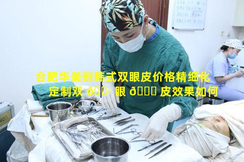 合肥华美割韩式双眼皮价格精细化定制双 🕷 眼 🍀 皮效果如何呢